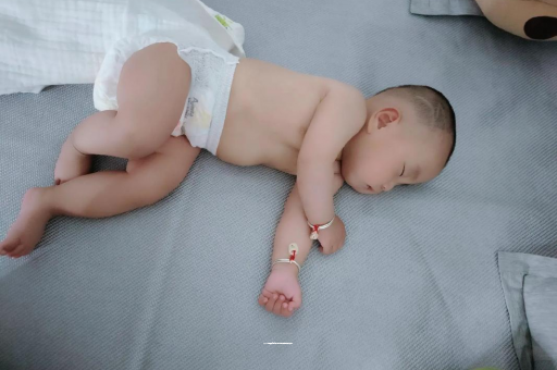 六安六个月宝宝眼睛散光